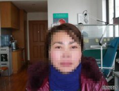 <b>裝仿真義眼，效果和真眼差不多嗎</b>