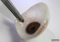 <b>超薄款與常規(guī)款義眼的不同之處在于哪里？</b>